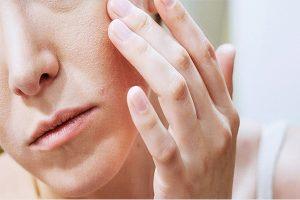 Da mặt bị ngứa và sần sùi phải làm sao?