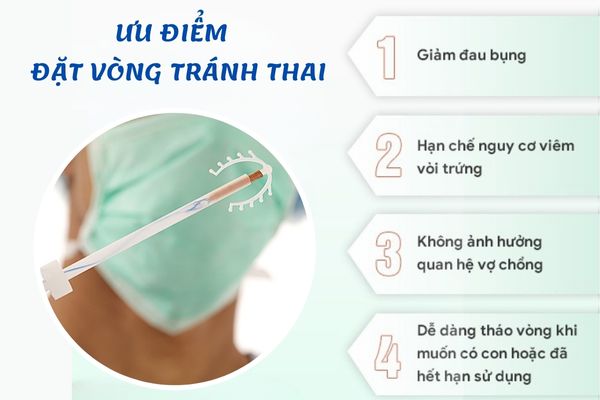 Ưu điểm của phương pháp đặt vòng tránh thai mang lại