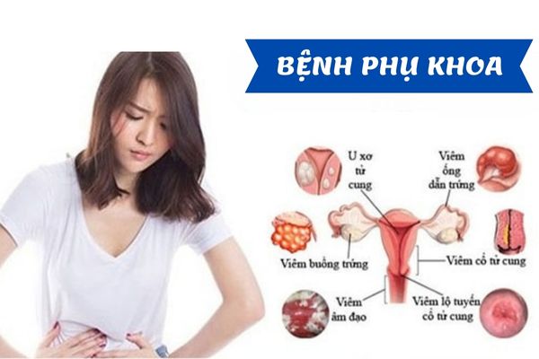 Khám phụ khoa giúp phát hiện ra bệnh lý liên quan đến chức năng sinh sản nữ giới