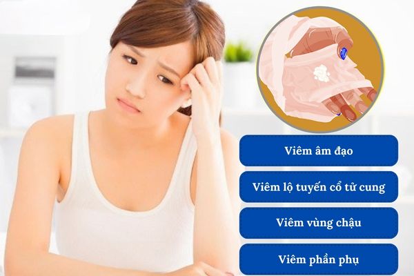 Nguyên nhân bệnh lý khiến khí hư có màu trắng đục