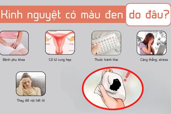 Kịnh nguyệt màu đen do nhiều nguyên nhân khác nhau gây nên