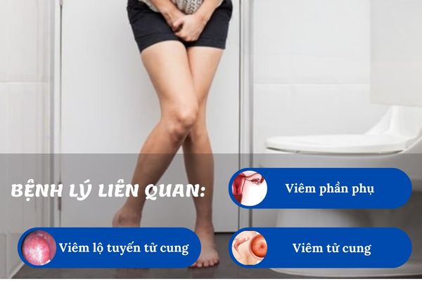 Ra chất nhầy màu trắng như lòng trắng trứng là cảnh báo bệnh lý nguy hiểm