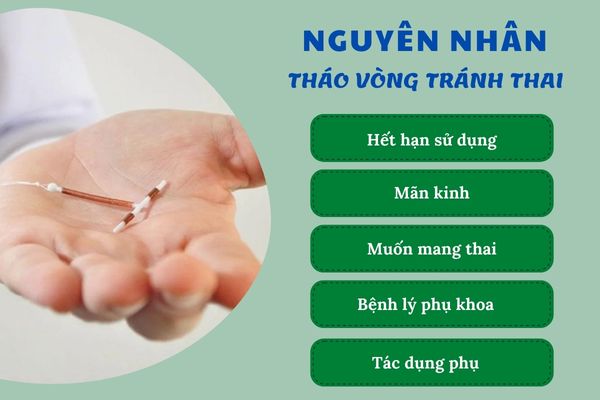 Nguyên nhân tháo vòng tránh thai