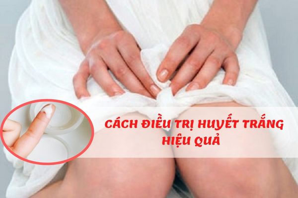 Huyết trắng ra nhiều và cách điều trị huyết trắng hiệu quả nhất