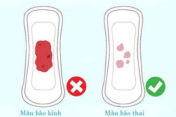 Máu báo thai là dấu hiệu có thai phổ biến nhất