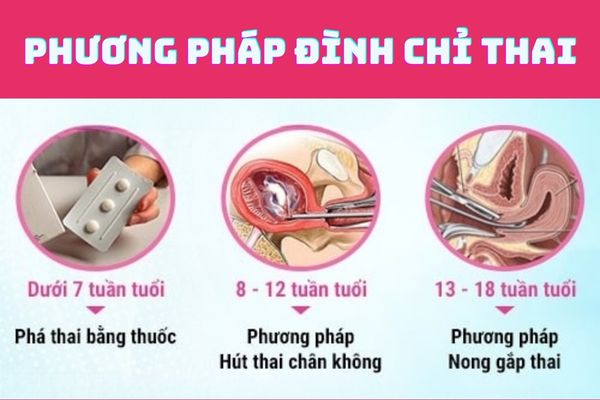 Các biện pháp đình chỉ thai an toàn