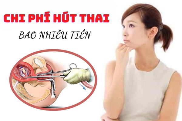 Chi phí hút thai hết bao nhiêu tiền? Có đắt không