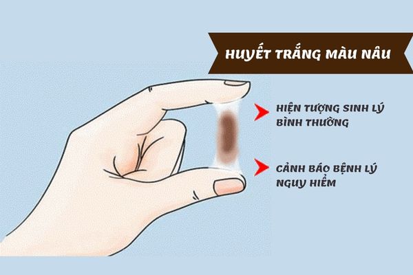 Huyết trắng màu nâu là vấn đề thường gặp ở nữ giới