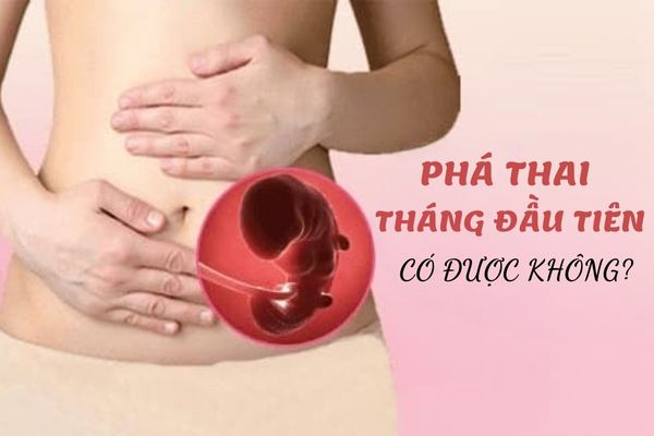 Phá thai tháng an toàn – Các mẹ bầu cần lưu ý