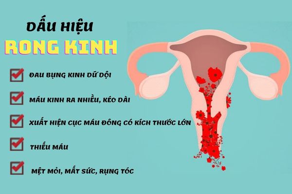 Rong kinh có nhiều dấu hiệu nhận biết cụ thể