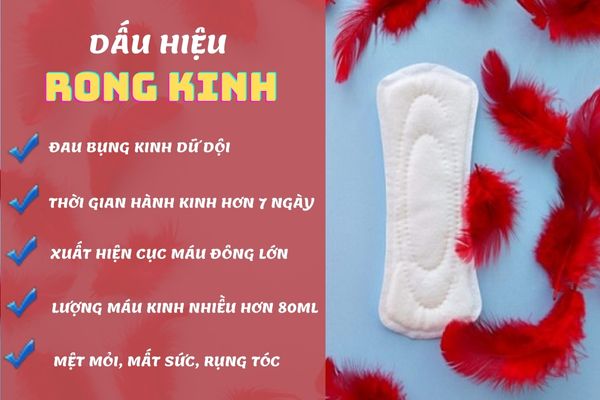 Rong kinh có nhiều dấu hiệu nhận biết cụ thể