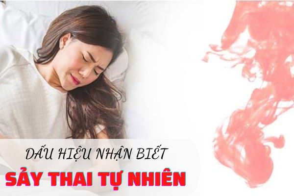 Các dấu hiệu sảy thai tự nhiên mẹ bầu cần lưu ý