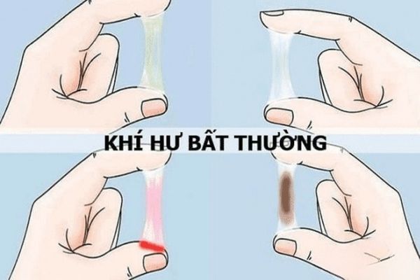 Huyết trắng bất thường sẽ có sự khác biệt về màu sắc