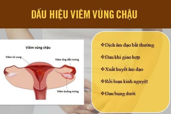 Viêm vùng chậu dẫn đến tình trạng đau rát vùng kín ở nữ giới