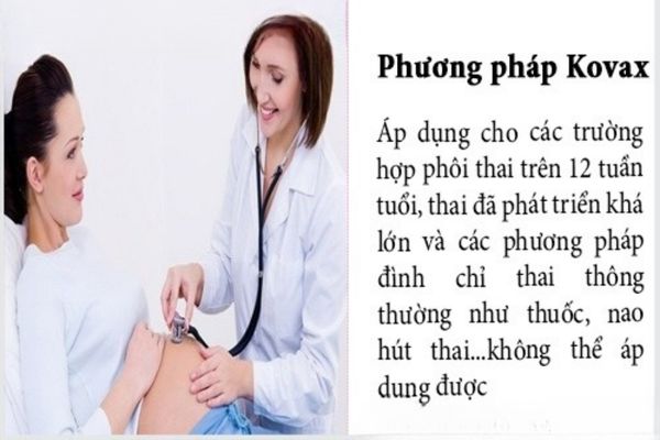 Kovax là phương pháp phá thai hiện đại