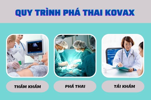 Quy trình phá thai Kovax tiêu chuẩn