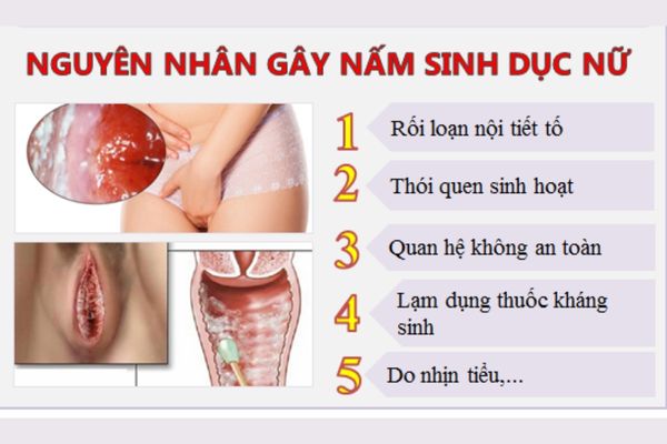 Nguyên nhân gây nhiễm nấm phụ khoa phổ biến