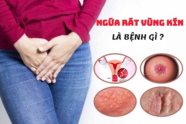 Ngứa rát vùng kín là bệnh gì? Cách điều trị hiệu quả