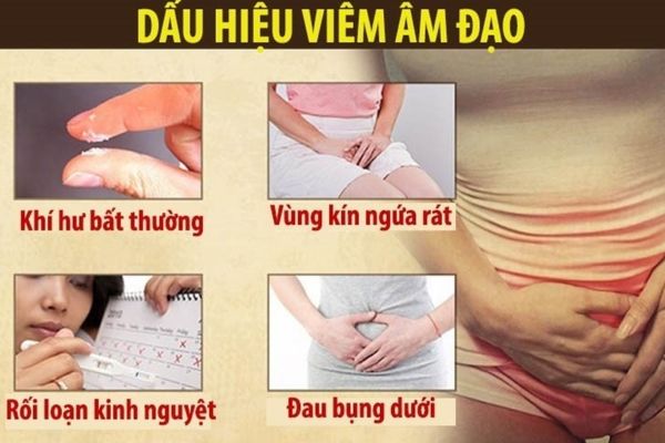 Dấu hiệu nhận biết viêm âm đạo ở nữ giới