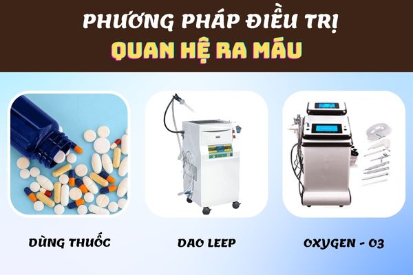 Phương pháp điều trị quan hệ ra máu hiệu quả, dứt điểm