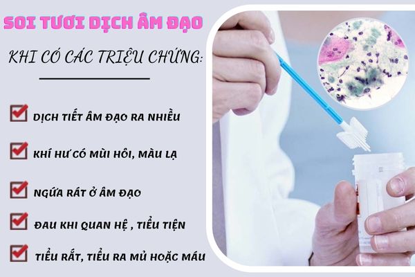 Nên soi dịch tươi âm đạo khi phát hiện khí hư bất thường