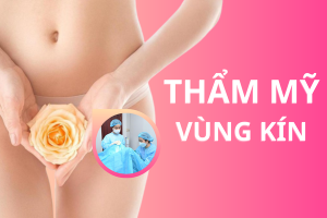 Thẩm mỹ vùng kín và những thông tin cần biết