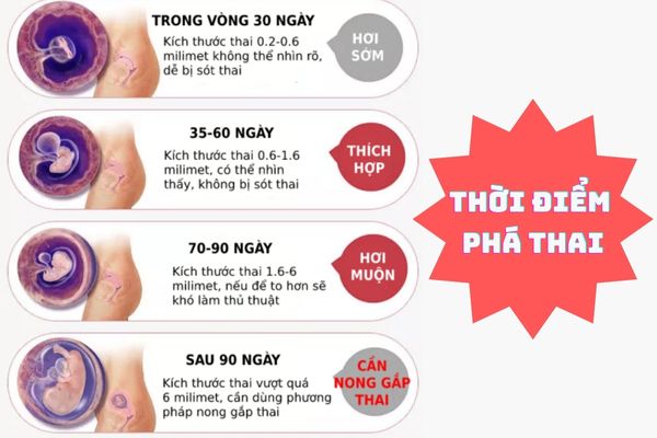 Thời điểm phá thai phù hợp nhất