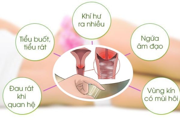 Xét nghiệm âm đạo ngay khi phát hiện khí hư bất thường