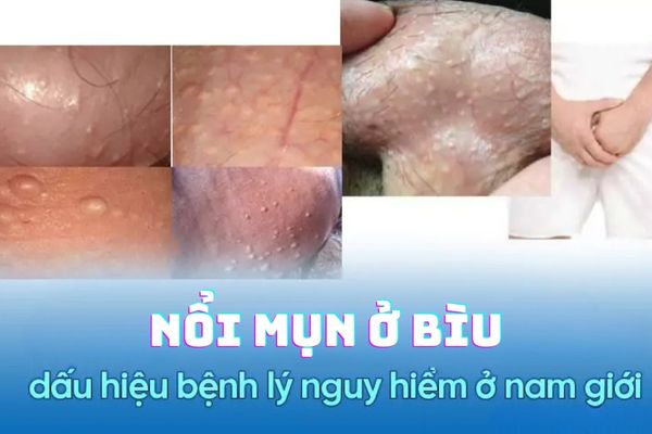 Noi-mun-o-biu