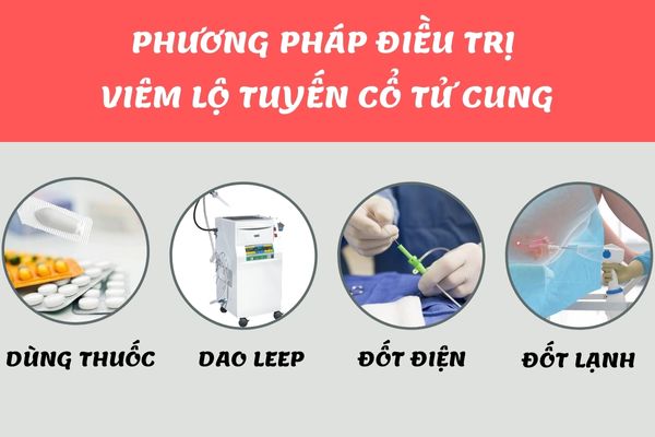 Phương pháp điều trị viêm lộ tuyến cổ tử cung hiệu quả