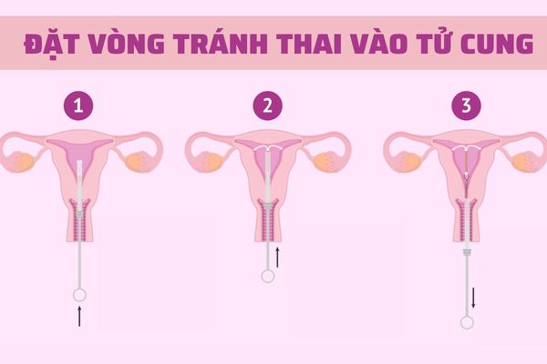 Dat-vong-tranh-thai-an-toan-tai-hai-duong (2)