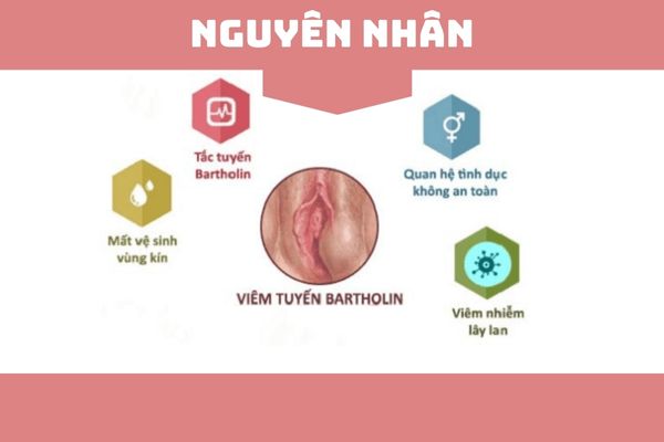 Tong-hop-nhung-thong-tin-ve-viem-tuyen-bartholin-1