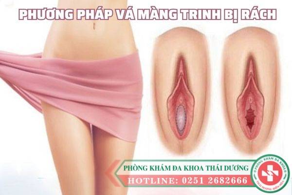 phuong-phap-va-mang-trinh-bi-rach (2)