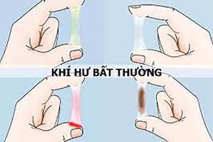 Huyết trắng có màu bất thường cảnh báo bệnh gì? Làm thế nào để khắc phục?