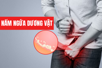 Nấm ngứa dương vật có nguy hiểm không? Cách điều trị như thế nào?