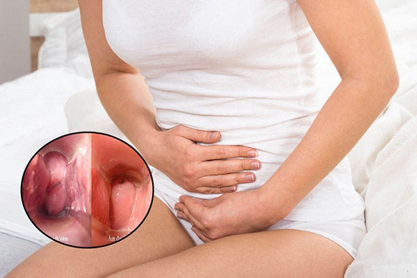 Một số bệnh vùng kín thường gặp ở nữ giới