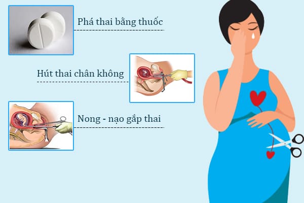 Cac-phuong-phap-dinh-chi-thai-ky-an-toan-va-pho-bien-hien-nay