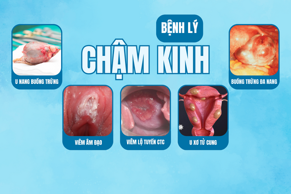 Cham-kinh-do-mang-thai-hay-mac-benh-phu-khoa-2