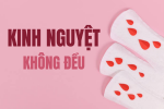 Kinh-nguyet-khong-deu-va-nhung-thong-tin-can-biet-0