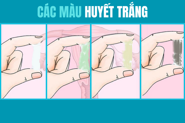 Ly-giai-cac-mau-huyet-trang-thuong-gap-1