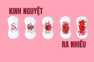 Những thông tin về kinh nguyệt ra nhiều