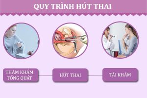 Tuổi thai nào có thể sử dụng phương pháp hút thai?