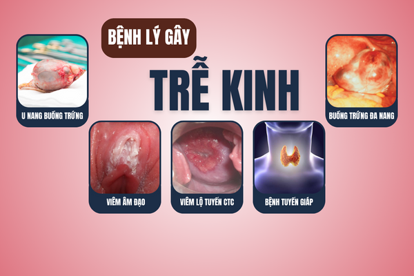 Thong-tin-ve-tre-kinh-can-het-suc-luu-y-2