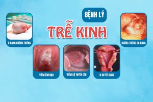 Tư vấn: Trễ kinh là bệnh lý hay mang thai? 