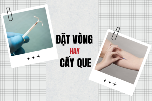 Nên đặt vòng hay cấy que tránh thai?