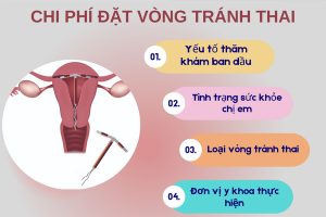 Chi phí đặt vòng tránh thai bao nhiêu? Đặt vòng ở đâu tốt?