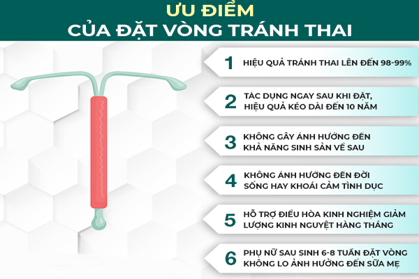 Những ưu điểm của phương pháp đặt vòng tránh thai