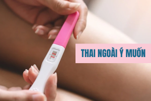 Mang thai ngoài ý muốn nên làm gì?