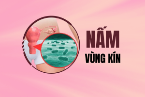 Những sự thật về nấm vùng kín