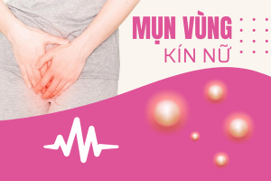 Nổi mụn vùng kín nữ giới đừng lơ là